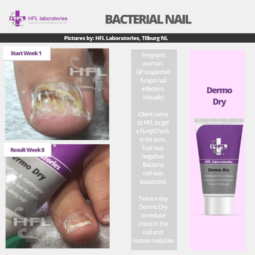 Dermo_Dry-_HFL_Laboratories