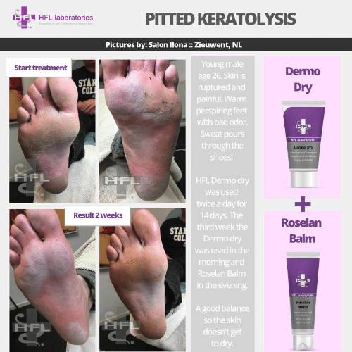 Dermo_Dry-_HFL_Laboratories_3