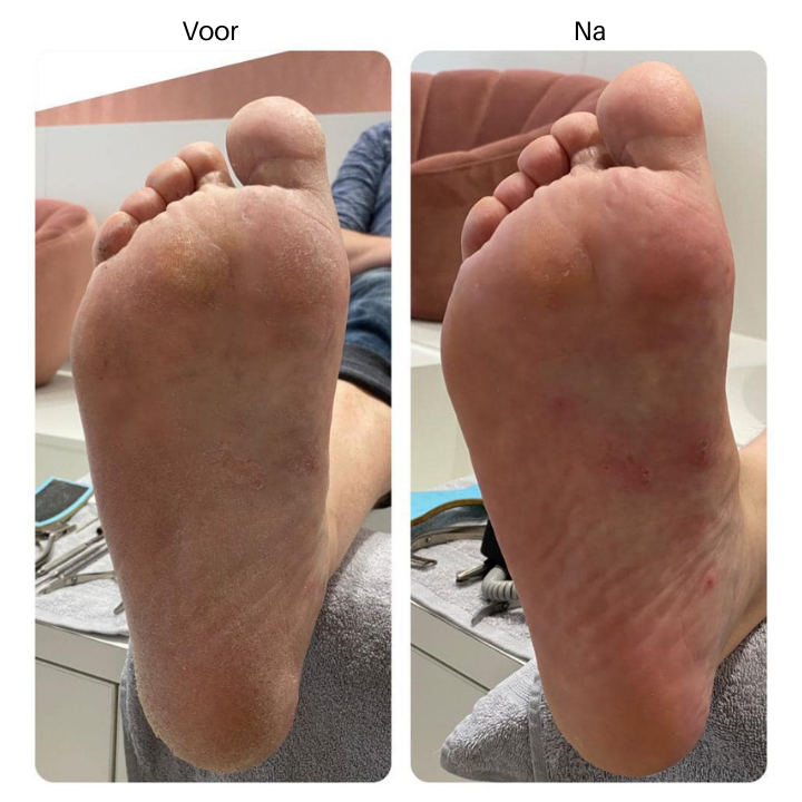 Duribland_resultaat_1_