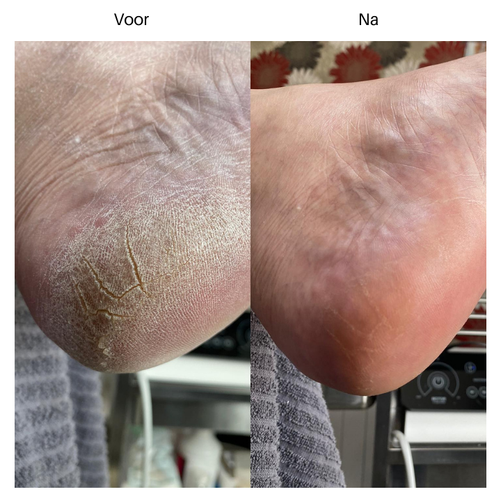 Duribland_resultaat_2__1