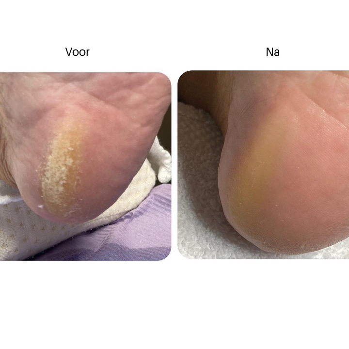 Duribland_resultaat_3_