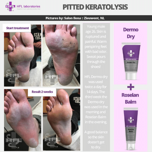 Roselan_Balm_Dermoleen_creme-_HFL_Laboratories_3