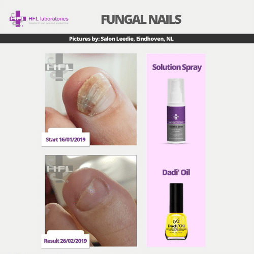 Solution_spray-_HFL_Laboratories_-_Resultaten_foto68