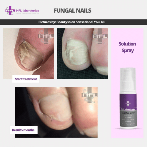 Solution_spray-_HFL_Laboratories_-_Resultaten_foto7