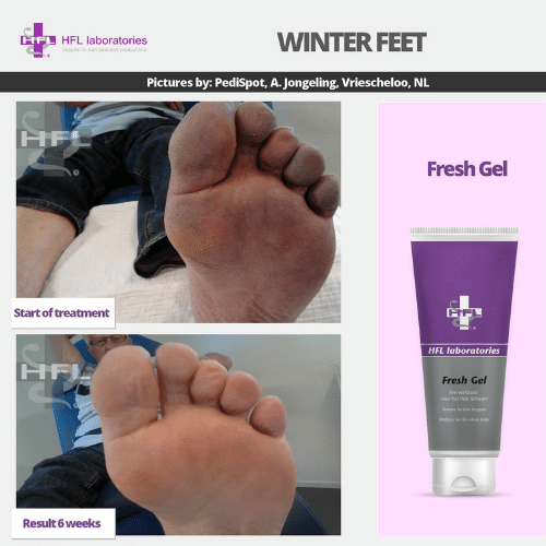 Untitled_design_-_2021-11-19T115812.033