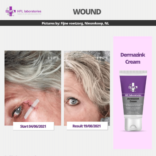 Untitled_design_-_2021-11-19T122810.381