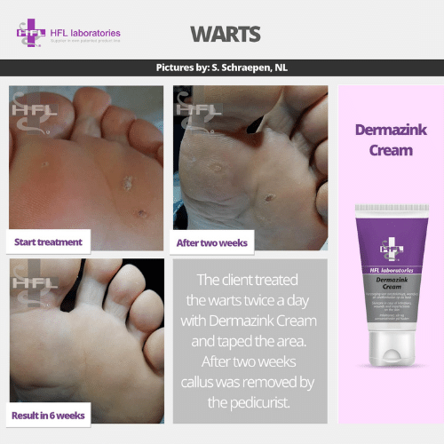 Untitled_design_-_2021-11-19T122829.088