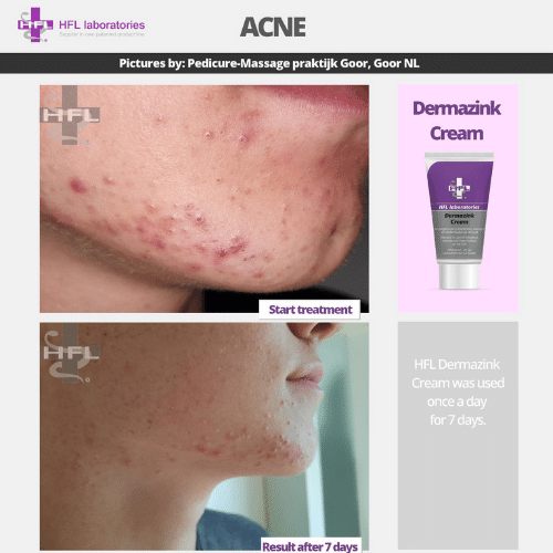 Untitled_design_-_2021-11-19T122857.142