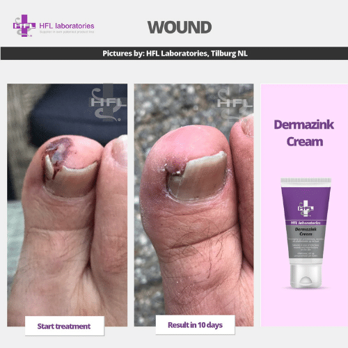 Untitled_design_-_2021-11-19T122919.476