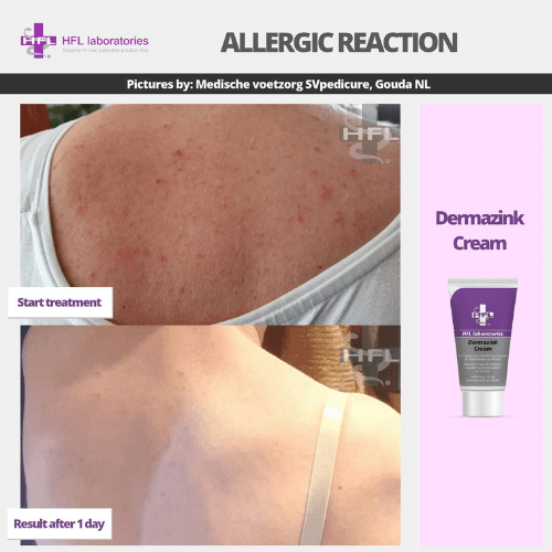 Untitled_design_-_2021-11-19T122946.737