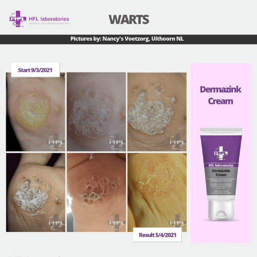 Untitled_design_-_2021-11-19T123010.258