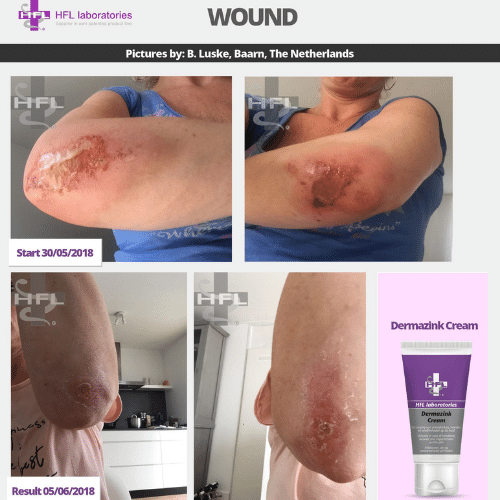 Untitled_design_-_2021-11-19T123117.312