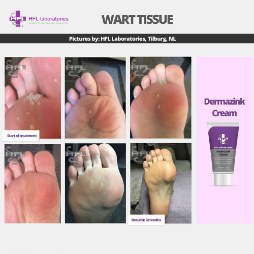 Untitled_design_-_2021-11-19T123156.743