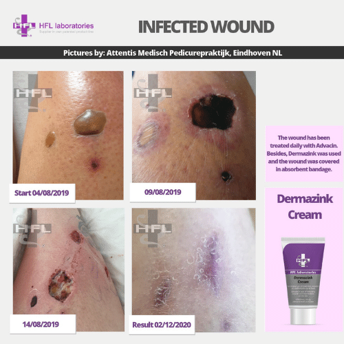 Untitled_design_-_2021-11-19T123246.865